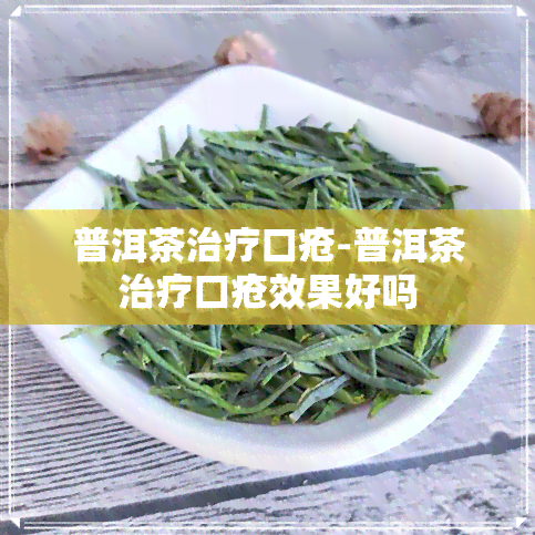 普洱茶治疗口疮-普洱茶治疗口疮效果好吗