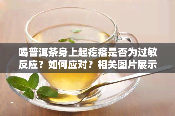 喝普洱茶身上起疙瘩是否为过敏反应？如何应对？相关图片展示