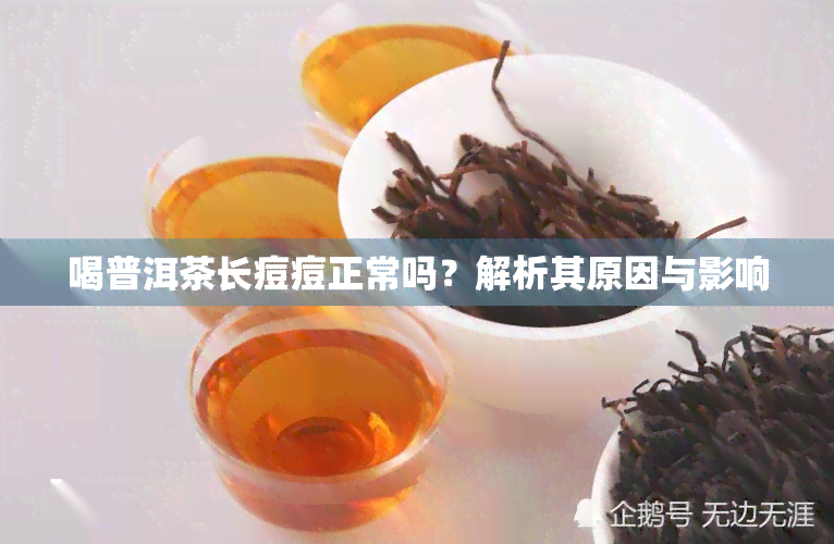 喝普洱茶长痘痘正常吗？解析其原因与影响