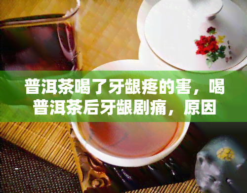 普洱茶喝了牙龈疼的害，喝普洱茶后牙龈剧痛，原因解析与解决方法