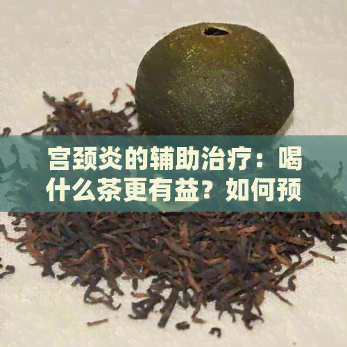 宫颈炎的辅助治疗：喝什么茶更有益？如何预防和缓解宫颈炎症状？