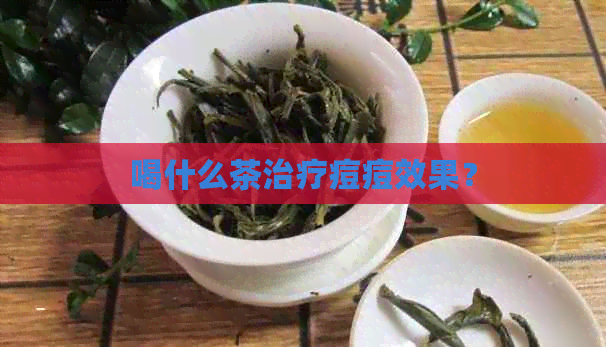 喝什么茶治疗痘痘效果？