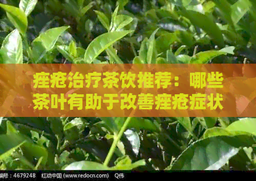 痤疮治疗茶饮推荐：哪些茶叶有助于改善痤疮症状？如何选择适合自己的茶品？