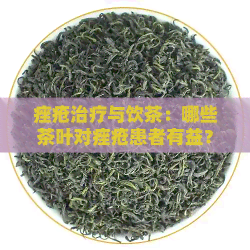 痤疮治疗与饮茶：哪些茶叶对痤疮患者有益？