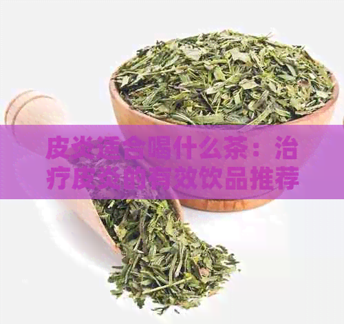 皮炎适合喝什么茶：治疗皮炎的有效饮品推荐