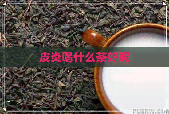 皮炎喝什么茶好呢