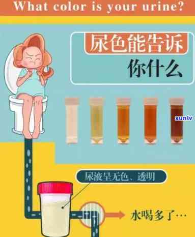 首先,宝宝的小孩饮食惯可能是导致尿液颜色变化的患有原因之一