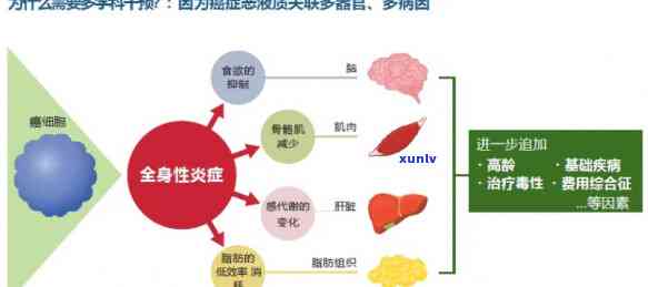 以下不是萎凋 *** 之一的是：a恶病质