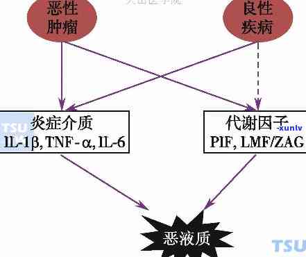 以下不是萎凋 *** 之一的是：a恶病质