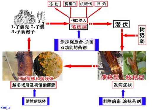 以下不是萎凋 *** 之一的是：a恶病质