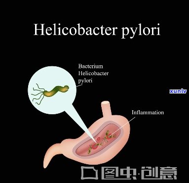 红茶能否杀死幽门螺杆菌？效果如何？可以饮用吗？——知乎探讨