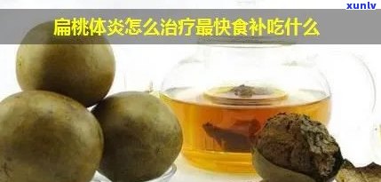 扁桃体炎喝什么茶好-扁桃体炎喝什么茶好得快