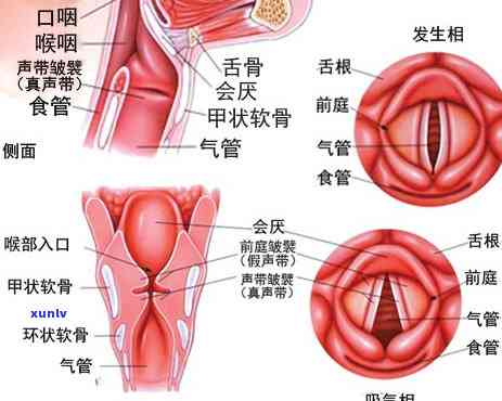 声带发炎喝什么茶好-声带发炎喝什么比较好