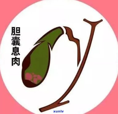 胆囊息肉喝什么茶可以消除，喝茶也能消胆囊息肉？这些茶或能帮到你！