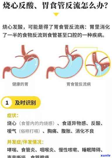 胃酸反流喝什么茶好-胃酸反流喝什么茶好一点