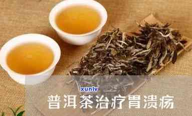 喝什么茶对胃溃疡好-喝什么茶对胃溃疡好呢