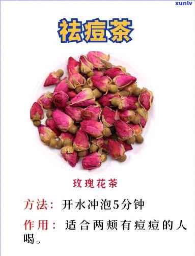 去痤疮的什么茶管用-去痤疮的什么茶管用啊