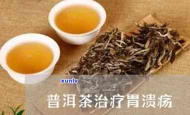 什么茶治疗胃溃疡，胃溃疡的救星：揭秘哪种茶有治疗效果？