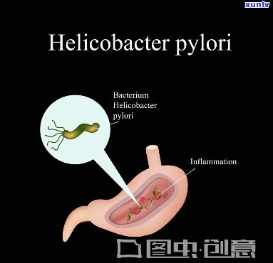 什么茶治疗幽门螺旋杆菌好，揭秘治疗幽门螺旋杆菌的茶叶