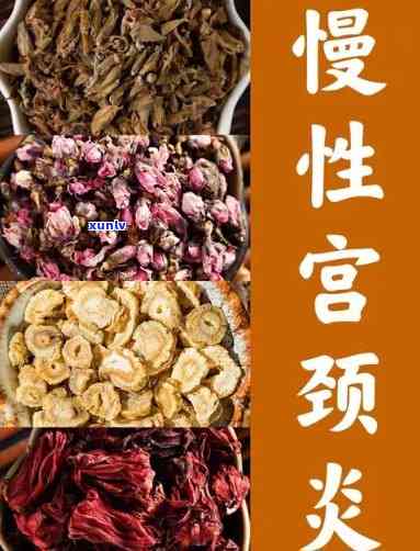 宫颈炎患者适合饮用哪些茶叶？全面解析