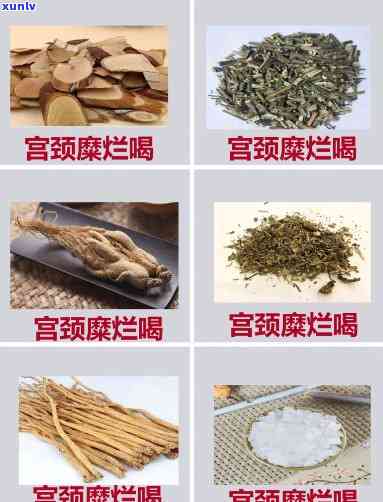 宫颈炎患者适合饮用哪些茶叶？全面解析