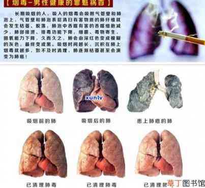 网上的清肺烟是真的吗，揭秘网上传言：清肺烟真的有效吗？