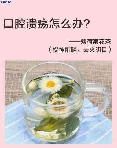 口腔溃烂喝什么茶好呢，口腔溃疡患者的救星：喝什么茶？