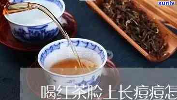 长水痘期间，女生是否适合饮用红茶？