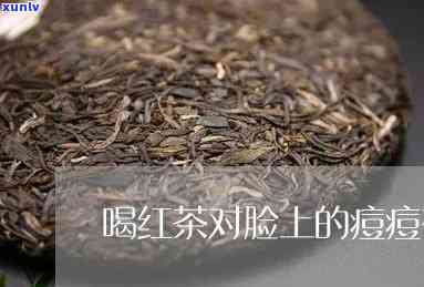 长水痘可以喝红茶吗-长水痘可以喝红茶吗女生