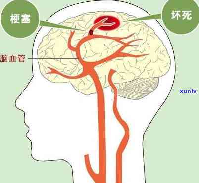 交通银行逾期2年无法一次性还款，应如何处理？