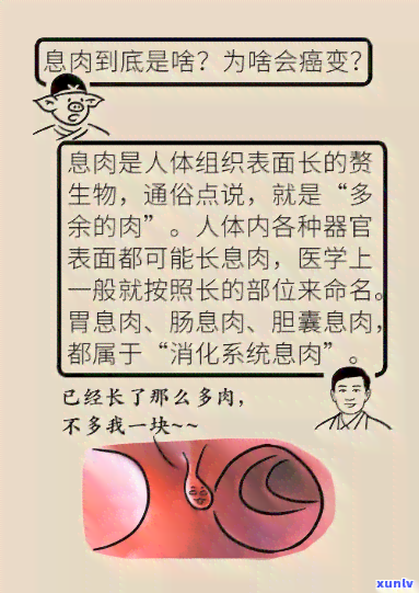 喝什么茶不长肠息肉-喝什么茶不长肠息肉呢