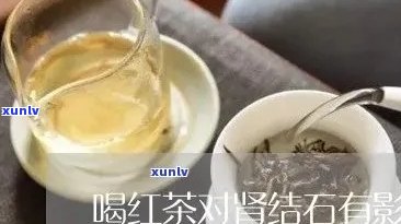 什么结石不能喝红茶-什么结石不能喝红茶叶