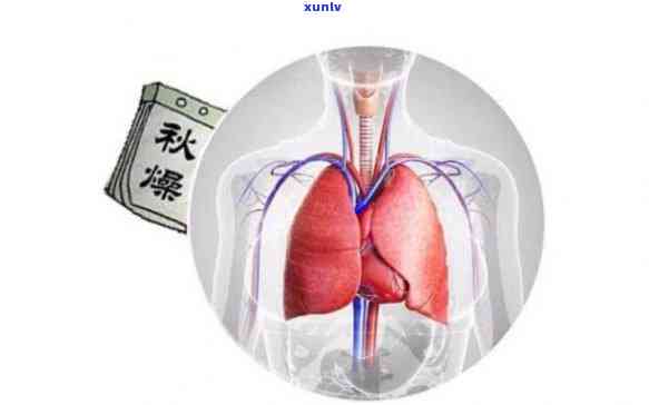 什么茶对气管和肺好-什么茶对气管和肺好呢