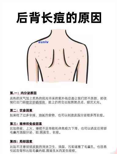 老班章普洱哪个好，排名、十大高端、厂生产、区别、茶厂