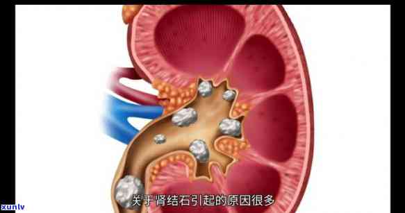 欠光大信用卡3万逾期一年未还，该怎样解决？