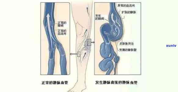 有钱花逾期怎么取证的-有钱花逾期怎么取证的啊