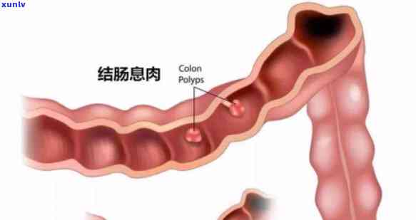 中信银行逾期上交材料是什么，中信银行逾期提交材料的结果和解决办法