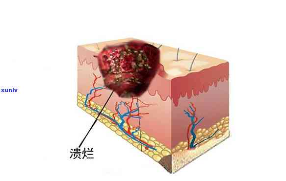 冰种翡翠吊件-冰种翡翠吊件图片