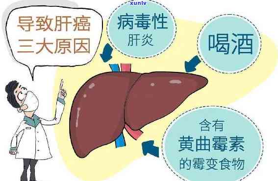 2021年信用卡逾期后果与解决方案：如何避免量刑并追回欠款？