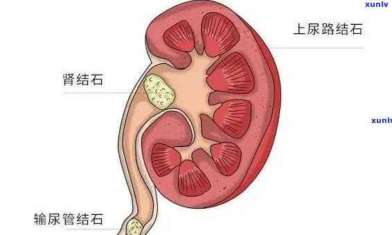 中信银行逾期多久催款有效？逾期多少天会上、给紧急联系人发信息及打 *** ？