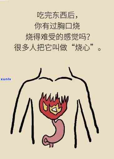 为什么一喝茶就烧心？原因与解决办法全解析