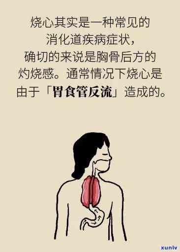 为什么一喝茶就烧心？原因与解决办法全解析