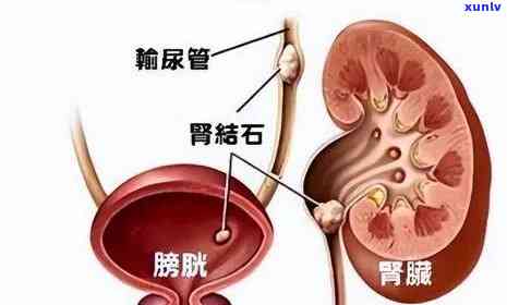 58快借逾期一天-58快借逾期一天会上吗是真的吗