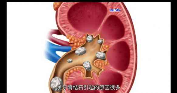 58快借逾期一天-58快借逾期一天会上吗是真的吗