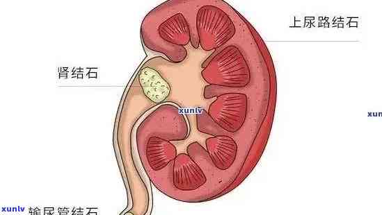 老班章普洱有收藏价值吗？价格查询表和口感特点