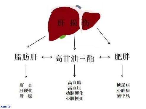 轻度脂肪肝喝茶可行吗？女性也适用吗？