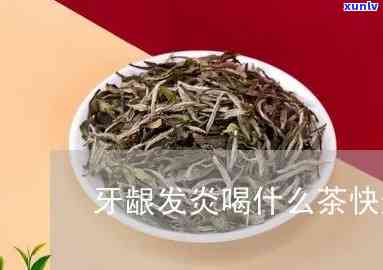 牙龈发炎可以喝茶吗-牙龈发炎可以喝茶吗?