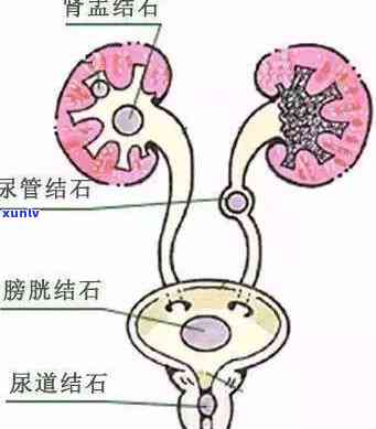 信用卡逾期20多天的影响与记录：详细解答常见疑问