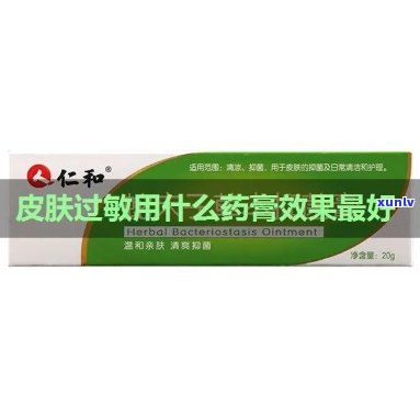 皮肤过敏吃什么药效果，寻找解决方案：皮肤过敏吃什么药最有效？