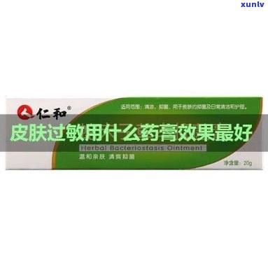 皮肤过敏什么药效果好？专家推荐有效及药膏